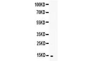 Western blot analysis of TNFSF18 using anti-TNFSF18 antibody .