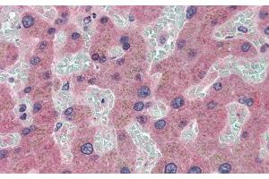 Detection of CP in Human Liver Tissue using Monoclonal Antibody to Ceruloplasmin (CP)