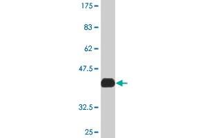 Western Blot detection against Immunogen (37. (MAPK6 anticorps  (AA 612-721))