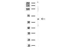 Western blot analysis of lysates from EC304 cells, using Phospho-Smad1 (Ser206) Antibody at 1/1000 dilution.