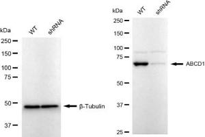 Western blotting analysis using ABCD1 antibody (ABIN7797686).