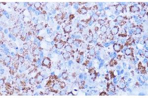 Immunohistochemistry of paraffin-embedded Rat ovary using ISG15 Polyclonal Antibody at dilution of 1:100 (40x lens).