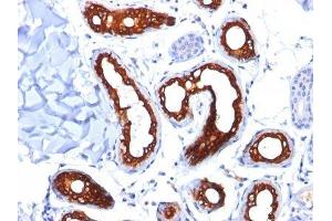 Image no. 2 for anti-Keratin 18 (KRT18) antibody (ABIN6179389) (Cytokeratin 18 anticorps)