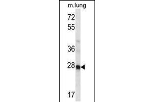 Western blot analysis in mouse lung tissue lysates (35ug/lane). (HOXA4 anticorps  (N-Term))