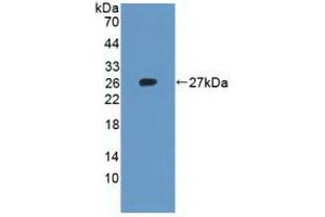 Detection of Recombinant RPL23A, Human using Polyclonal Antibody to Ribosomal Protein L23A (RPL23A) (RPL23A anticorps  (AA 2-156))