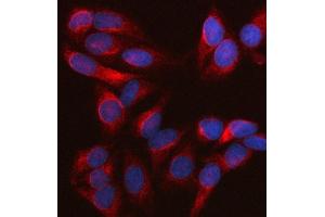 IF analysis of Nesprin 2/SYNE2 using anti-Nesprin 2/SYNE2 antibody (ABIN7601532).