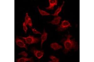 ABIN6276397 staining HepG2 by IF/ICC. (Interleukin 17a anticorps  (Internal Region))