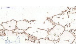 Immunohistochemistry of paraffin-embedded Human lung tissue using Desmin Monoclonal Antibody at dilution of 1:200.