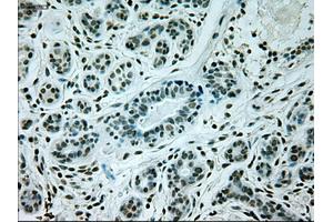 Immunohistochemical staining of paraffin-embedded breast tissue using anti-GAD1 mouse monoclonal antibody. (GAD anticorps)