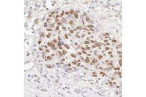 anti-General Transcription Factor IIIC, Polypeptide 5 (GTF3C5) (AA 469-519) antibody