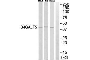 Western blot analysis of extracts from HeLa cells, HuvEc cells and 293 cells, using B4GALT5 antibody. (B4GALT5 anticorps  (C-Term))