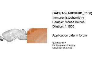 Immunohistochemistry (IHC) image for anti-gamma-aminobutyric Acid (GABA) A Receptor, alpha 3 (GABRA3) (Middle Region) antibody (ABIN2776110) (GABRA3 anticorps  (Middle Region))