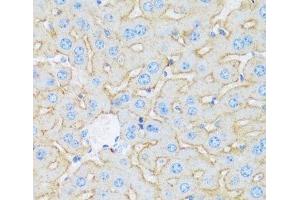 Immunohistochemistry of paraffin-embedded Mouse liver using ASGR1 Polyclonal Antibody at dilution of 1:100 (40x lens). (Asialoglycoprotein Receptor 1 anticorps)