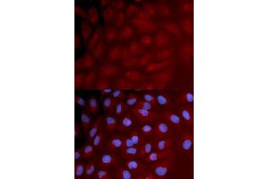 Immunofluorescence analysis of U2OS cell using IRF3 antibody.