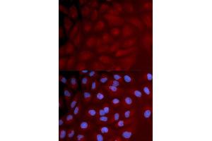 Immunofluorescence analysis of U2OS cell using IRF3 antibody. (IRF3 anticorps)