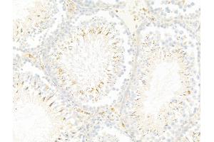ABIN7094885 and ABIN7098938 at 1/100 staining Rat testis tissue by IHC-P. (LIF anticorps  (N-Term))