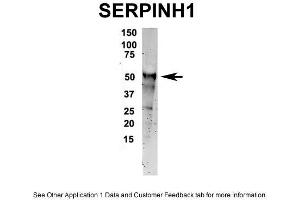 IP Suggested Anti-SERPINH1 Antibody Positive Control: NT2 CELL/BRAIN TISSUE (SERPINH1 anticorps  (C-Term))