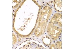 Immunohistochemistry of paraffin-embedded human kidney using XIAP antibody (ABIN5974139) at dilution of 1/100 (40x lens). (XIAP anticorps)