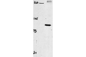 Western blot of chicken brain tissue incubated with CLC4 Antibody (C-term). (CLCN4 anticorps  (C-Term))