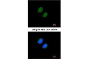 ICC/IF Image Immunofluorescence analysis of paraformaldehyde-fixed HeLa, using Proteasome 20S alpha5, antibody at 1:200 dilution.
