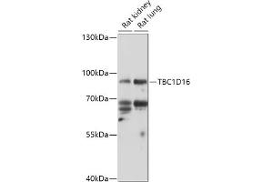Western blot analysis of extracts of various cell lines, using TBC1D16 antibody (ABIN7270746) at 1:1000 dilution.
