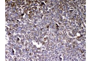 IHC testing of FFPE mouse liver tissue with VDBP antibody at 1ug/ml. (Vitamin D-Binding Protein anticorps)