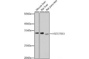 Western blot analysis of extracts of various cell lines using HSD17B13 Polyclonal Antibody at dilution of 1:1000. (HSD17B13 anticorps)