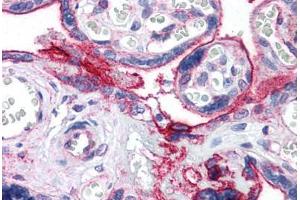 Human Placenta: Formalin-Fixed, Paraffin-Embedded (FFPE)