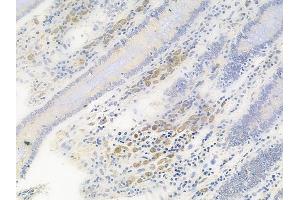 ABIN6256423 and ABIN6267512 at 1/100 staining human normal colon tissue by IHC-P.