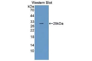 Detection of Recombinant TLR5, Human using Monoclonal Antibody to Toll Like Receptor 5 (TLR5)
