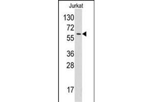 Western blot analysis of anti-YARS Pab (ABIN391838 and ABIN2841677) in Jurkat cell line lysates (35 μg/lane). (YARS anticorps  (N-Term))