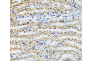 Immunohistochemistry of paraffin-embedded Mouse kidney using C4BPB Polyclonal Antibody at dilution of 1:100 (40x lens). (C4BPB anticorps)