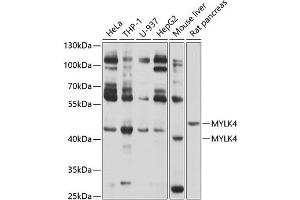 Western blot analysis of extracts of various cell lines, using MYLK4 antibody (ABIN6133126, ABIN6144268, ABIN6144269 and ABIN6214097) at 1:1000 dilution.