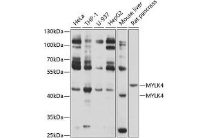 Western blot analysis of extracts of various cell lines, using MYLK4 antibody (ABIN6133126, ABIN6144268, ABIN6144269 and ABIN6214097) at 1:1000 dilution. (MYLK4 anticorps  (AA 119-388))