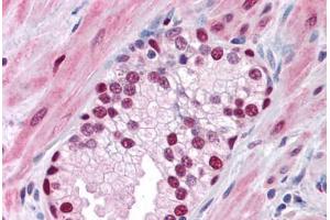 Human Prostate: Formalin-Fixed, Paraffin-Embedded (FFPE)