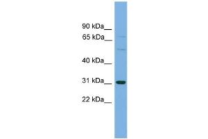 WB Suggested Anti-SLCO1B1 Antibody Titration: 0. (SLCO1B1 anticorps  (Middle Region))