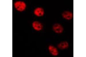 ABIN6267690 staining Hela by IF/ICC.