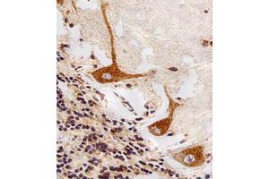 Immunohistochemical staining of paraffin-embedded human cerebellum section reacted with PPT1 monoclonal antibody  at 1:25 dilution.