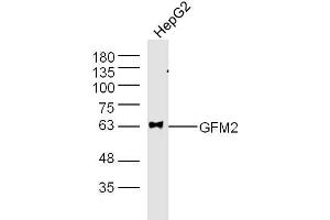 HepG2 (Human cell line) lysates probed with GFM2 Polyclonal Antibody, unconjugated  at 1:300 overnight at 4°C followed by a conjugated secondary antibody at 1:10000 for 60 minutes at 37°C. (GFM2 anticorps  (AA 151-250))