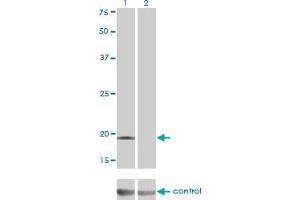 Western blot analysis of DCTD over-expressed 293 cell line, cotransfected with DCTD Validated Chimera RNAi (Lane 2) or non-transfected control (Lane 1). (DCMP Deaminase (DCTD) (AA 69-178) anticorps)