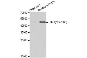 Western blot analysis of extracts from HT29 cells untreated or treated with UV, using Phospho-ELK1-S383 antibody (ABIN5969890). (ELK1 anticorps  (pSer383))