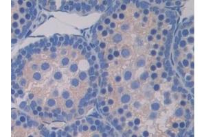 Detection of PDK4 in Mouse Testis Tissue using Polyclonal Antibody to Pyruvate Dehydrogenase Kinase 4 (PDK4)