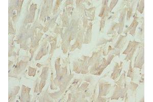 IHC analysis of paraffin-embedded human heart tissue, using NT-proBNP antibody (1/100 dilution).