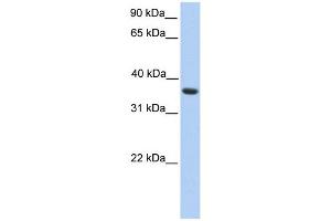 MAGEA4 antibody used at 1 ug/ml to detect target protein. (MAGEA4 anticorps  (C-Term))