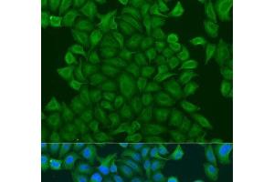 Immunofluorescence analysis of U2OS cells using GSTM3 Polyclonal Antibody at dilution of 1:100. (GSTM3 anticorps)