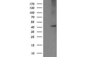 Image no. 4 for anti-Carboxypeptidase A2 (Pancreatic) (CPA2) antibody (ABIN1497598)