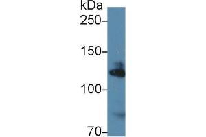 Western Blot; Sample: Human K562 cell lysate; Primary Ab: 1µg/ml Rabbit Anti-Mouse ADD1 Antibody Second Ab: 0. (alpha Adducin anticorps  (AA 388-560))