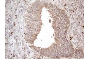 Immunohistochemistry (IHC) image for anti-Amelotin (AMTN) antibody (ABIN2716039)