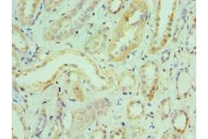 Immunohistochemistry of paraffin-embedded human kidney tissue using ABIN7156720 at dilution of 1:100 (Interleukin enhancer-binding factor 3 (ILF3) (AA 785-894) anticorps)