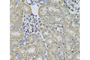 Immunohistochemistry of paraffin-embedded Rat kidney using AP2A1 Polyclonal Antibody at dilution of 1:100 (40x lens). (alpha Adaptin anticorps)